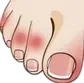 calluses warts icon